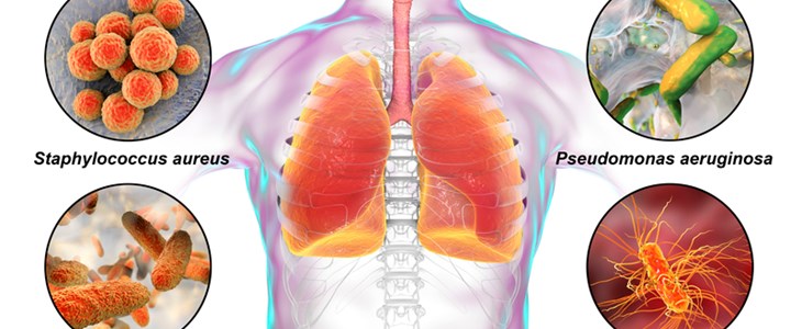 Bakterielle Infektionen sind zweithäufigste Todesursache weltweit